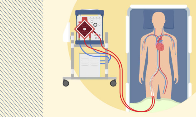 Hospital Badim passa a oferecer terapia de ECMO