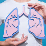 Pneumonia: saiba como prevenir a condição que levou famosos a serem internados para tratamento