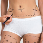 Cirurgia plástica: o que você precisa saber antes de realizar o procedimento? 