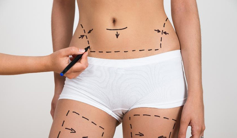 Cirurgia plástica: o que você precisa saber antes de realizar o procedimento? 